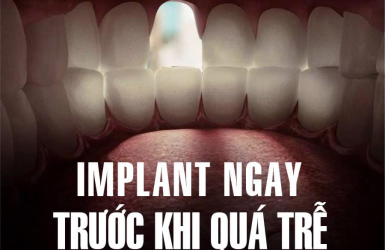 Hậu Quả Nghiêm Trọng Khi Mất Răng Lâu Ngày