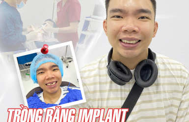 Cấy Ghép Implant