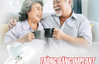 Trồng Răng Implant