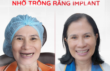 C&ocirc; Lan