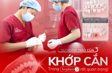 KHỚP CẮN &ndash; YẾU TỐ QUYẾT ĐỊNH ĐỘ BỀN CỦA IMPLANT