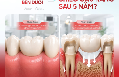 ĐIỀU G&Igrave; XẢY RA B&Ecirc;N DƯỚI CHIẾC CẦU RĂNG SAU 5 NĂM?