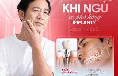 NGHIẾN RĂNG KHI NGỦ C&Oacute; PH&Aacute; HỎNG IMPLANT?