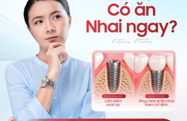 Đặt Implant xong c&oacute; thể ăn nhai ngay?