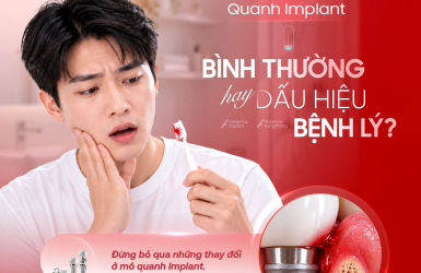 Chảy m&aacute;u quanh Implant: B&igrave;nh thường hay bệnh l&yacute;?