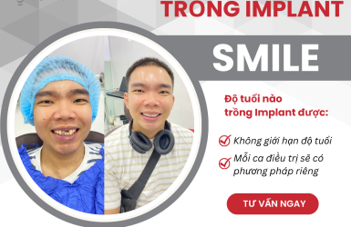 Bao Nhiêu Tuổi Thì Trồng Răng Implant Được?