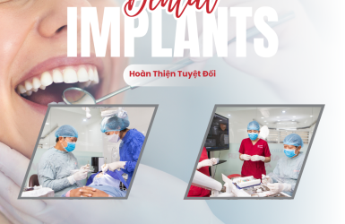 Địa Chỉ Trồng Răng Implant Tại TPHCM Uy Tín Và An Toàn