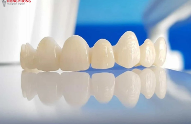Có Nên Bọc Răng Sứ Không? Những Ai Nên Và Không Nên Bọc Răng Sứ?