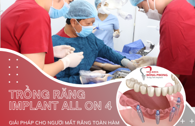 Implant All On 4 Giá Bao Nhiêu?【Phục Hình Toàn Diện】
