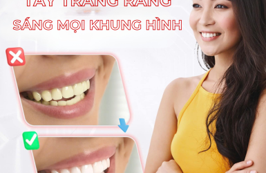 Nha Khoa Thẩm Mỹ-Tẩy Trắng Răng