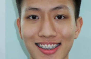 Anh Minh Ho&agrave;ng