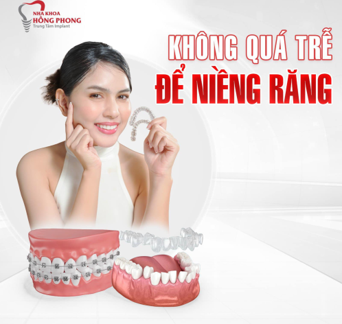 Niềng Răng Trong Suốt Ở Đâu Uy Tín Tại TP.HCM?