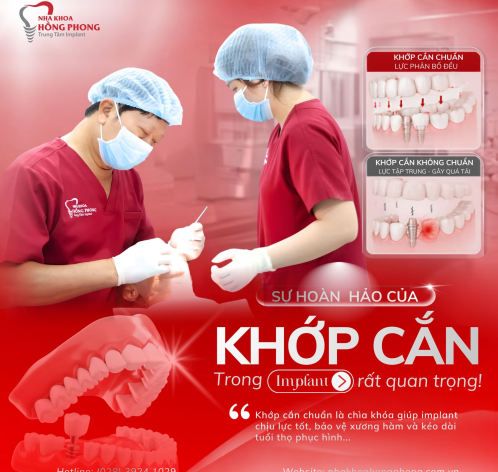 KHỚP CẮN &ndash; YẾU TỐ QUYẾT ĐỊNH ĐỘ BỀN CỦA IMPLANT