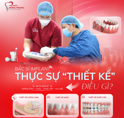 B&Aacute;C SĨ IMPLANT THỰC SỰ &ldquo;THIẾT KẾ&rdquo; ĐIỀU G&Igrave;?