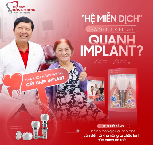 "HỆ MIỄN DỊCH&rdquo; ĐANG L&Agrave;M G&Igrave; QUANH IMPLANT?