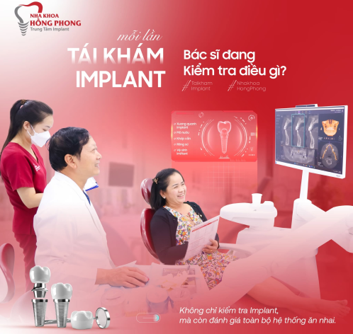 T&Aacute;I KH&Aacute;M IMPLANT: B&Aacute;C SĨ ĐANG KIỂM TRA ĐIỀU G&Igrave;?