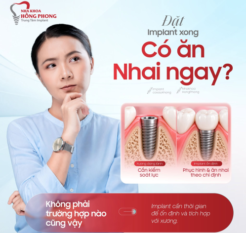 Đặt Implant xong c&oacute; thể ăn nhai ngay?