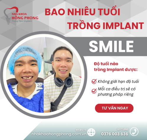 Bao Nhiêu Tuổi Thì Trồng Răng Implant Được?