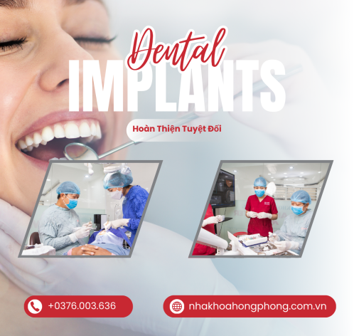 Địa Chỉ Trồng Răng Implant Tại TPHCM Uy Tín Và An Toàn