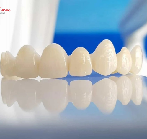 Có Nên Bọc Răng Sứ Không? Những Ai Nên Và Không Nên Bọc Răng Sứ?