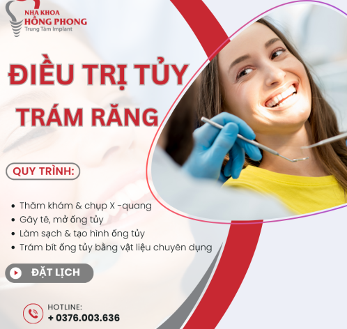 Top 1 Địa Chỉ Điều Trị Tủy Răng Uy Tín Tại TPHCM