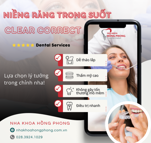 Lợi Ích Của Niềng Răng Trong Suốt Và Hạn Chế [✔️Điều Cần Biết]