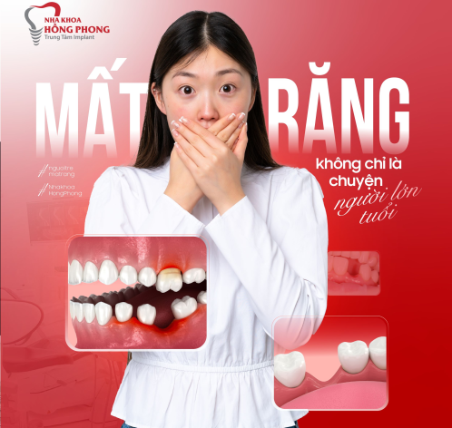 Ngày càng nhiều người trẻ mất răng sớm: Chuyện mất răng không chỉ của người già