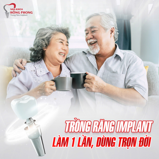 Trồng Răng Implant