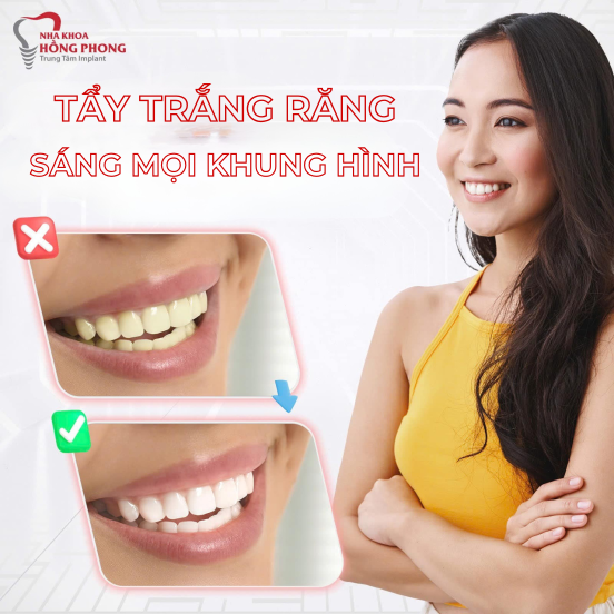 Nha Khoa Thẩm Mỹ-Tẩy Trắng Răng