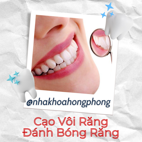 NKTQ - Đánh Bóng