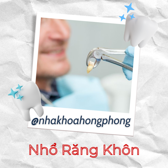 NKTQ - Răng Khôn