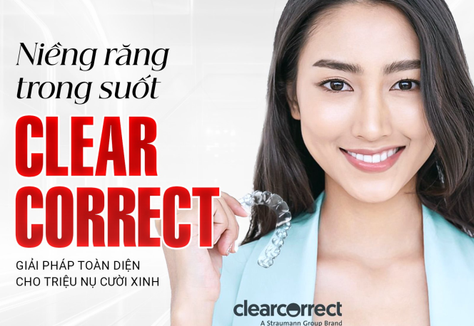 Trường Hợp Nên Niềng Răng Trong Suốt Clear Correct?