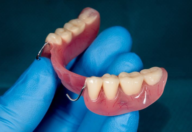 Trường Hợp Nên Phục Hình Tháo Lắp