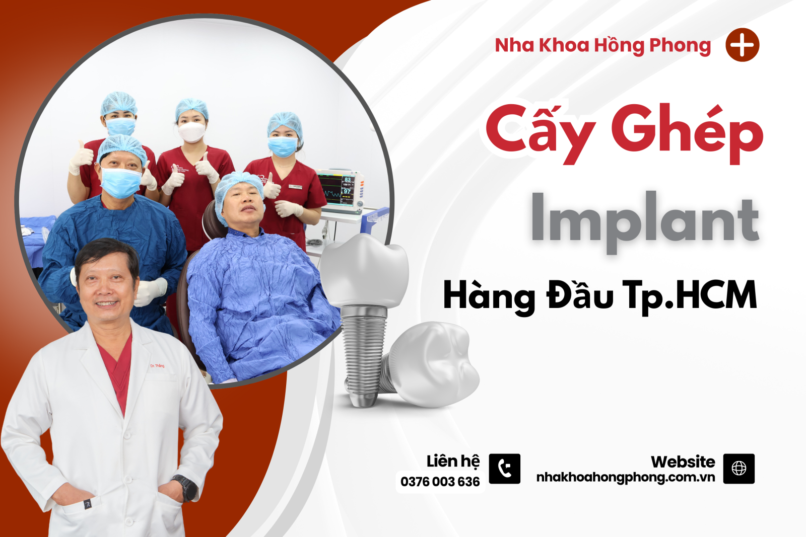 Chia Sẻ Của Lê Khắc Toản Sau Khi Cấy Ghép Implant