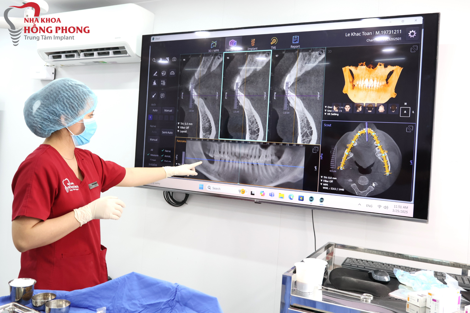 Cấy Ghép Implant Uy Tín Tại Tp.HCM