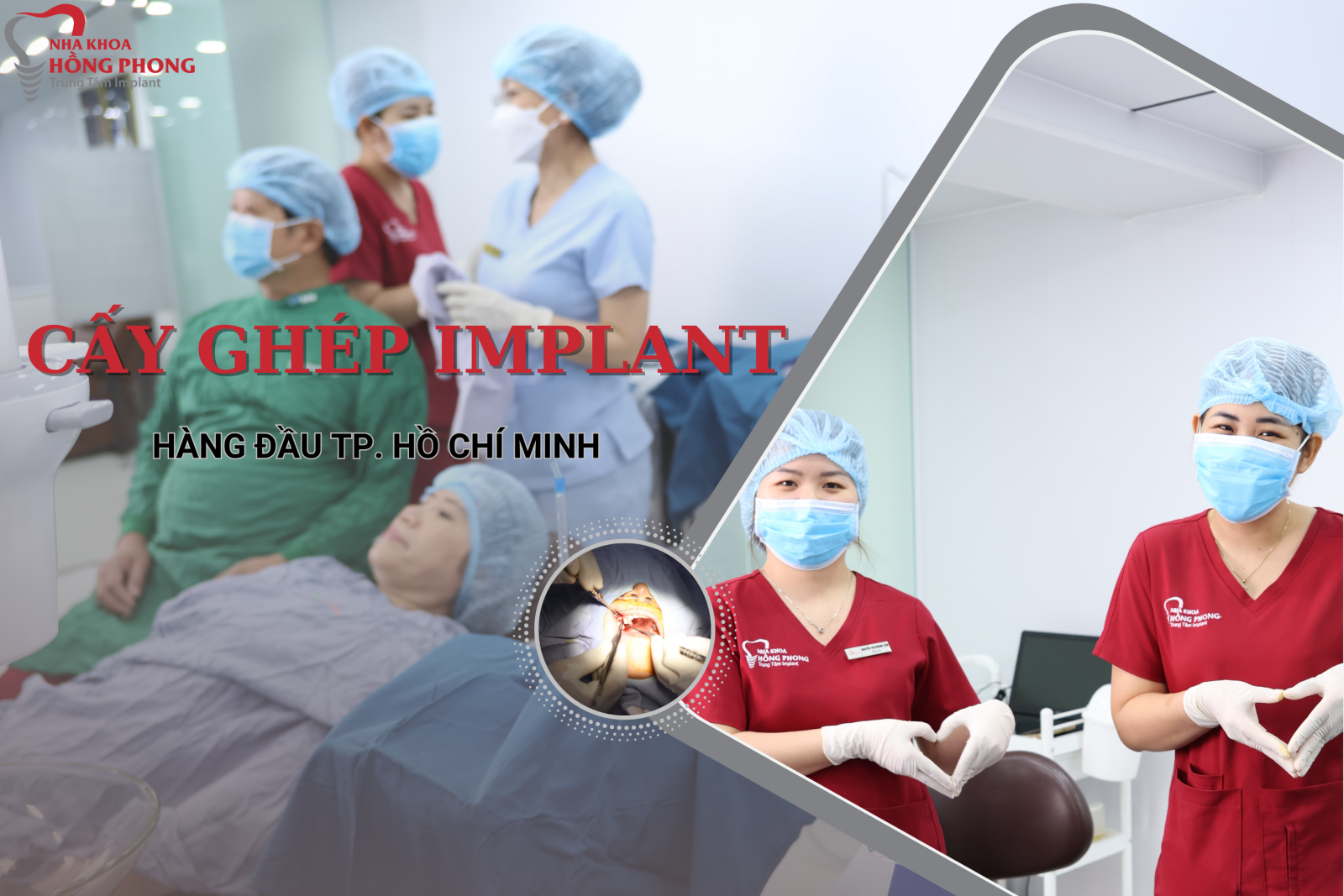 Phùng Xuân Hạnh Thực Hiện Thành Công Cấy Ghép Implant