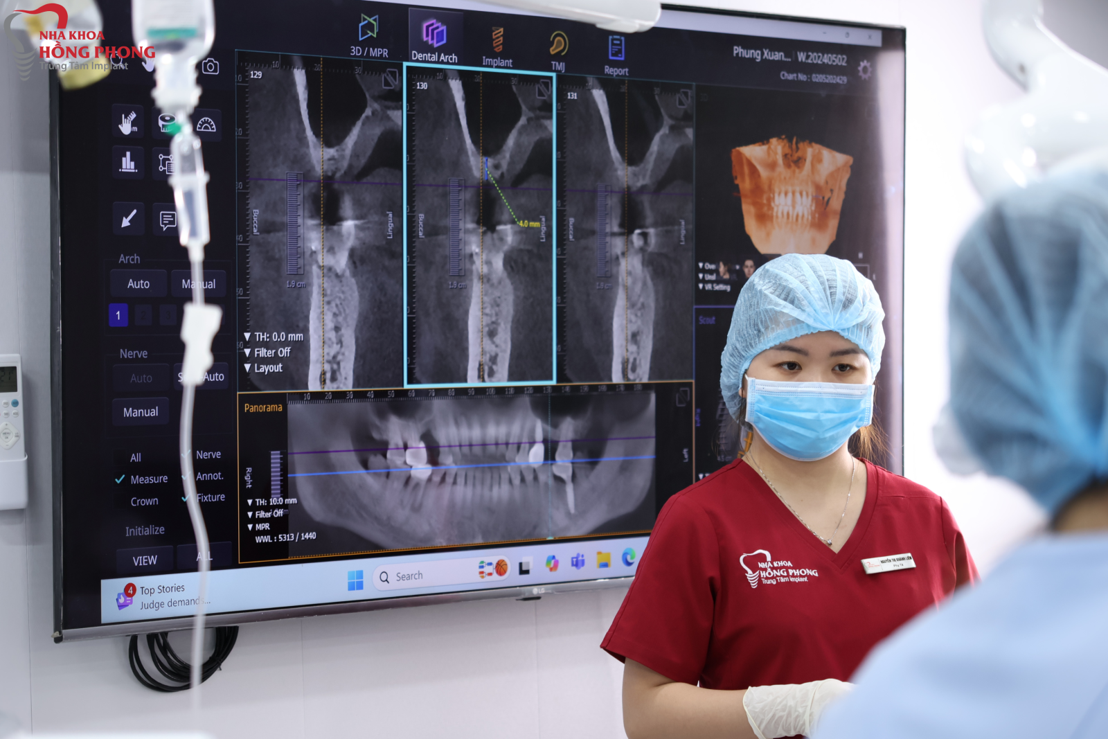 Phùng Xuân Hạnh Thực Hiện Thành Công Cấy Ghép Implant