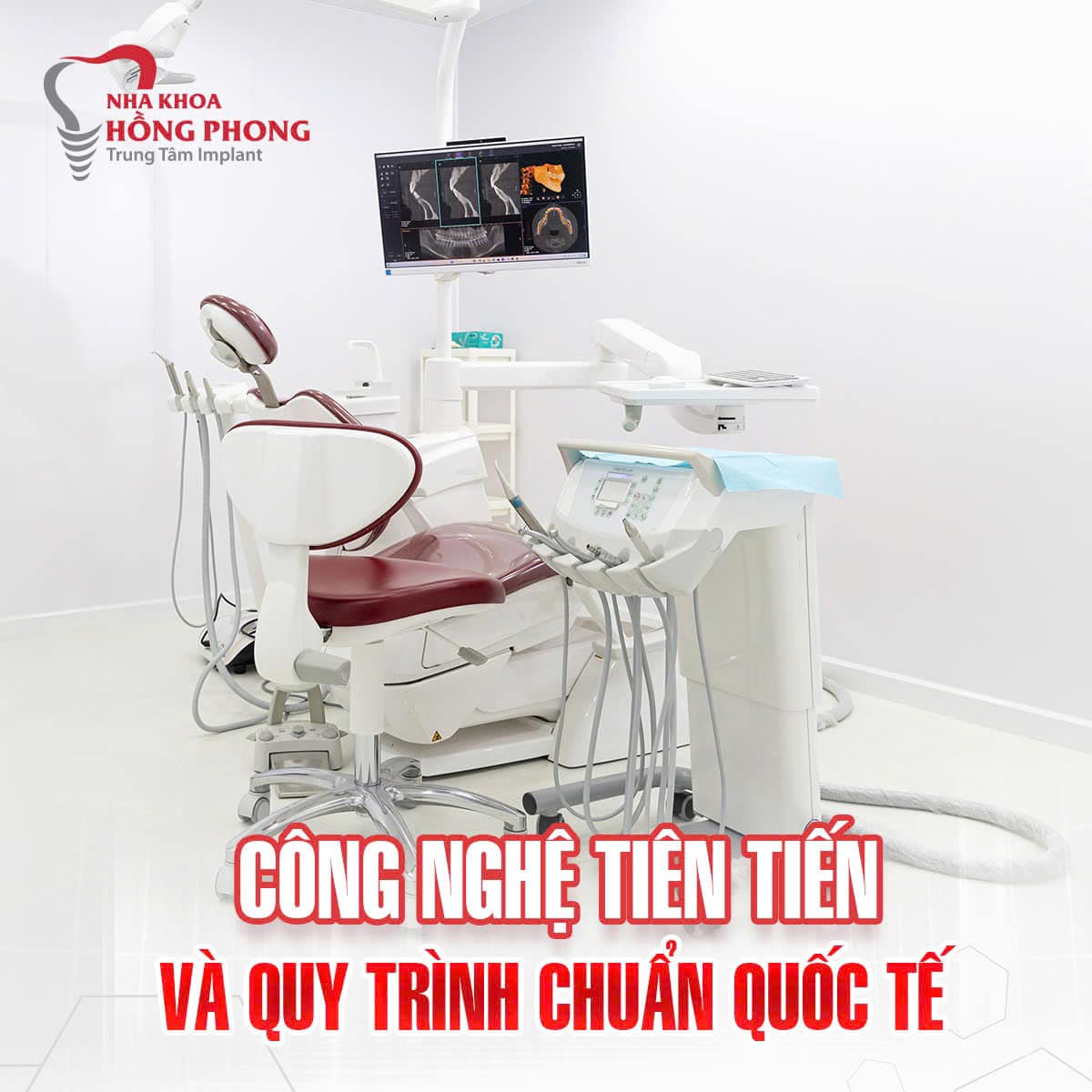 Công Nghệ Hiện Đại Tại Nha Khoa Hồng Phong