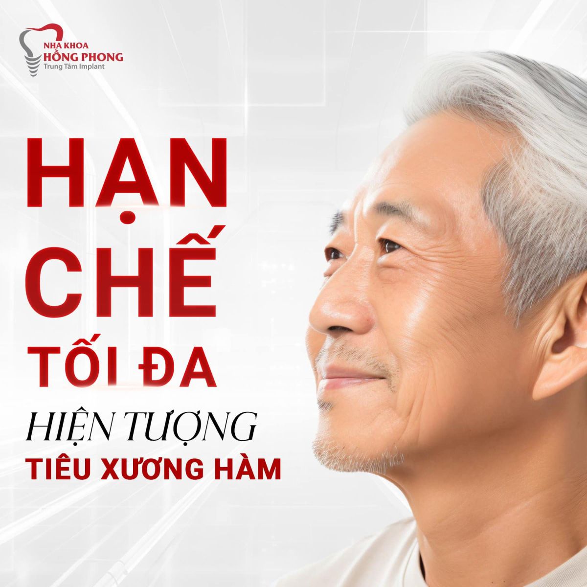3 Lợi Ích Khi Trồng Răng Implant Cho Người Cao Tuổi