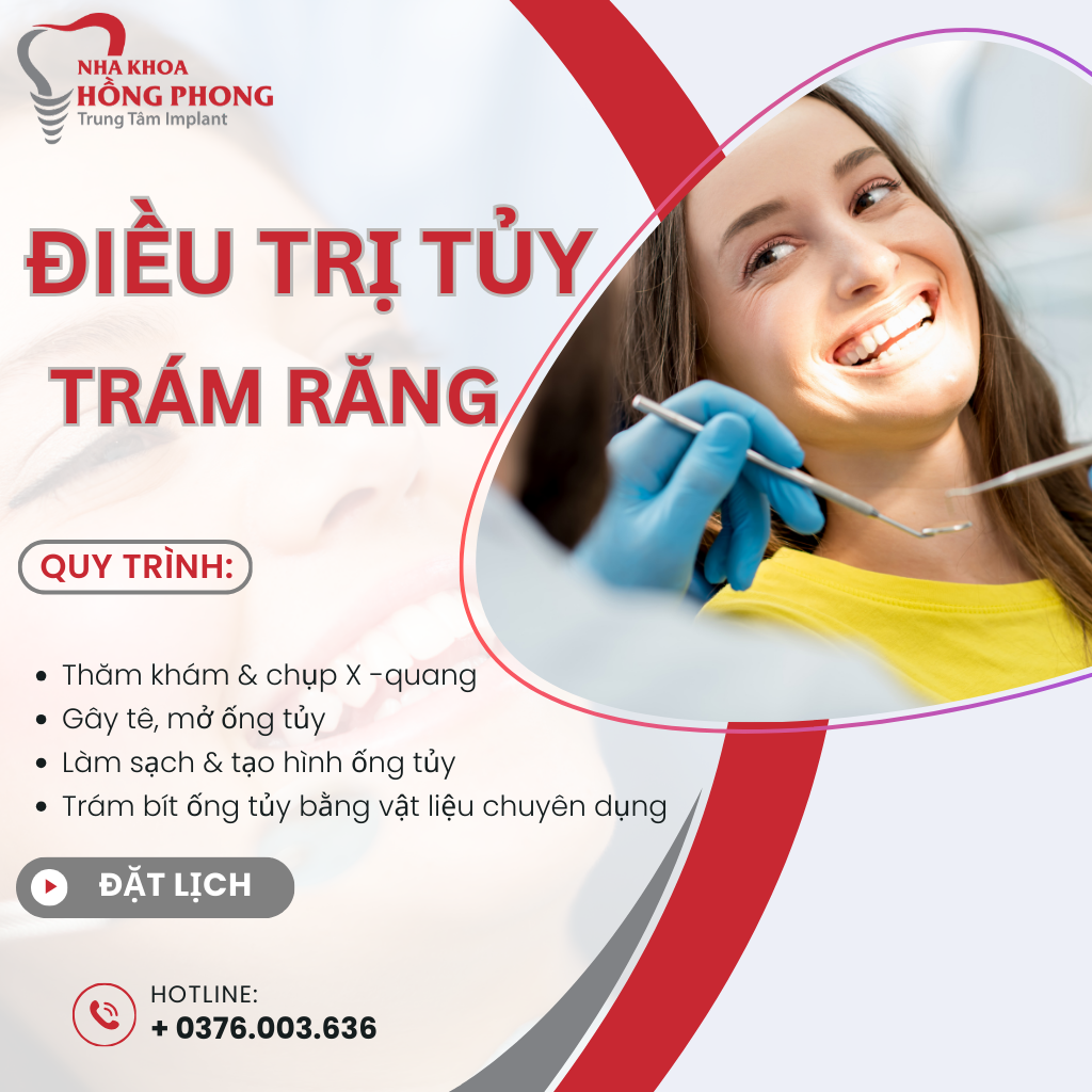 Top 1 Địa Chỉ Điều Trị Tủy Răng Uy Tín Tại TPHCM
