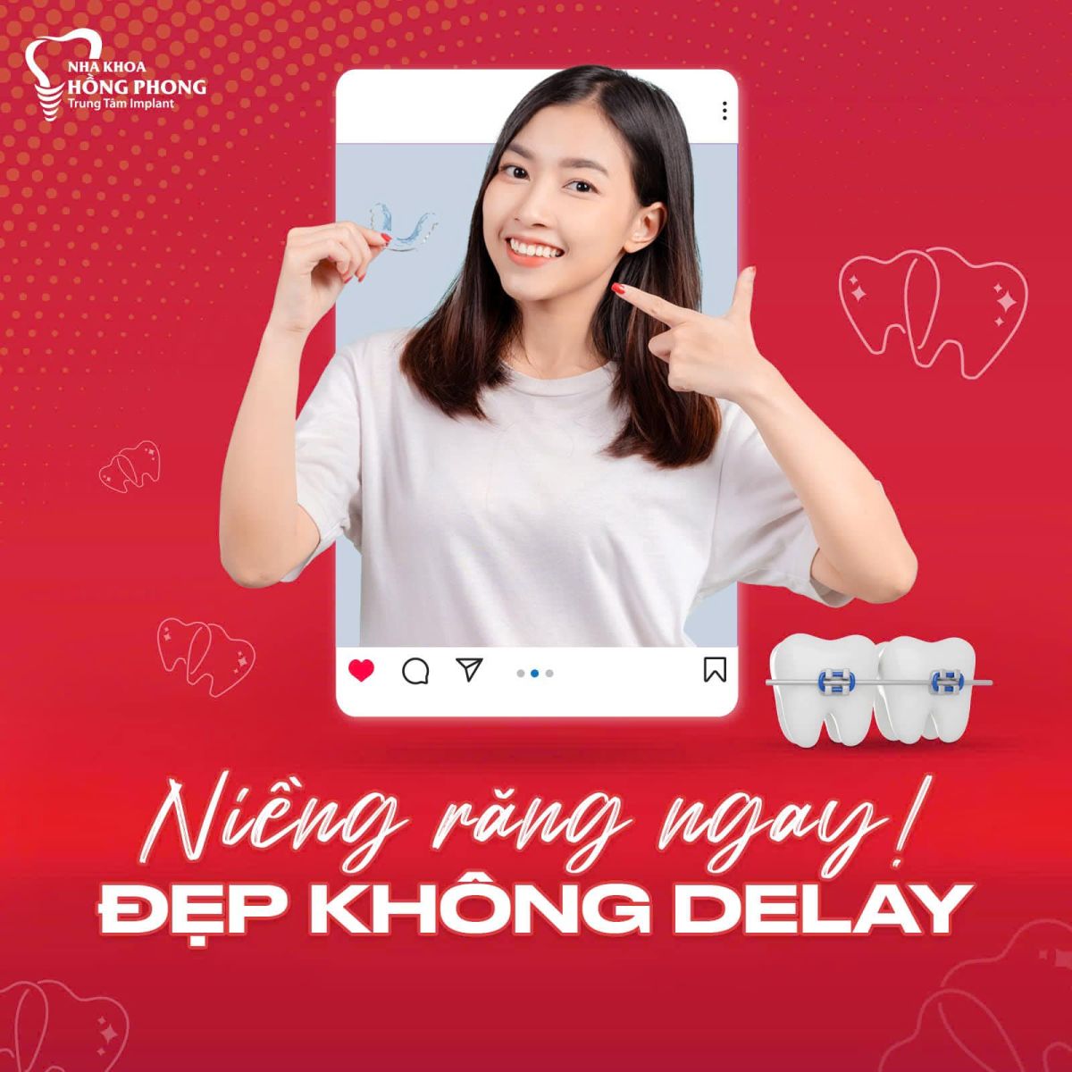 Niềng Răng Trong Suốt ClearCorrect 