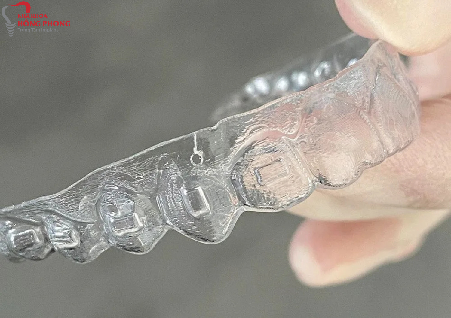 Niềng Răng Trong Suốt ClearCorrect