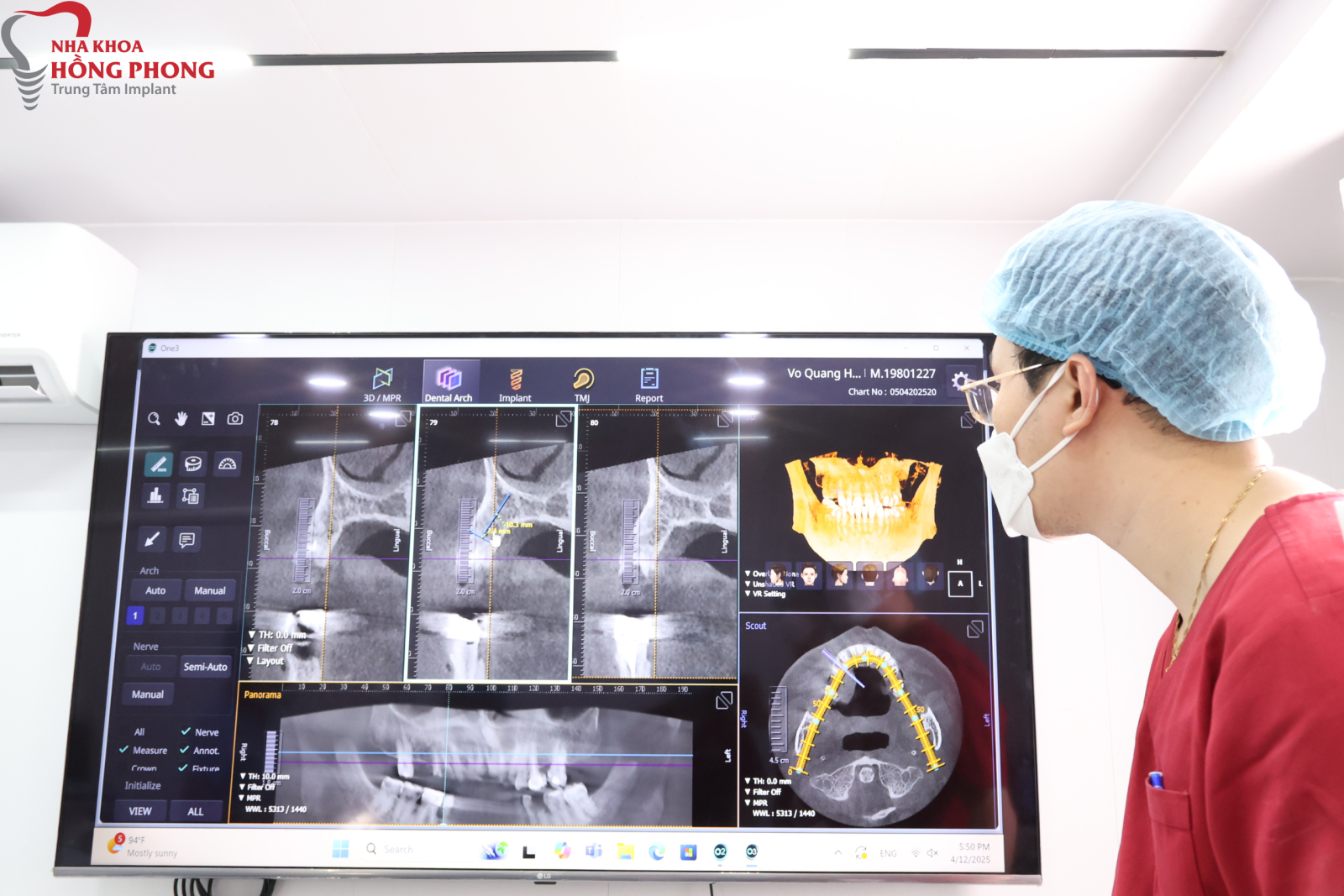 Hình ảnh cắt ra từ phim CT Conebeam