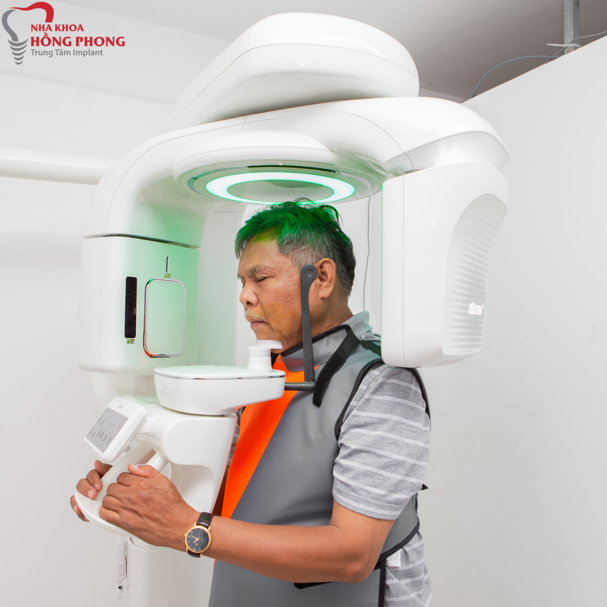 Chụp phim CT Conebeam – Bước Đột Phá Trong Trồng Răng Implant