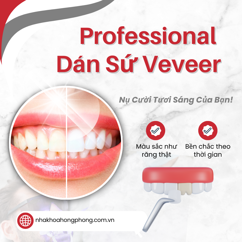 Nha Khoa Dán Sứ Veneer Tốt Nhất Quận 5 Tp.HCM