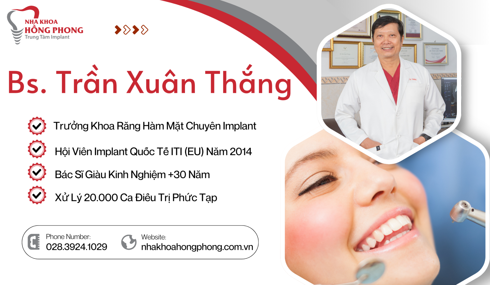 Trồng Răng Implant | Quy Trình & Bảng Giá Cấy Implant 2025